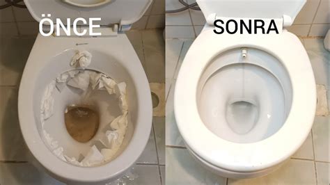 sararmış tuvalet nasıl temizlenir